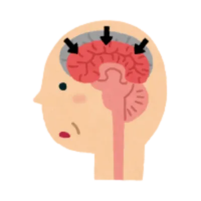 Cognitive Changes